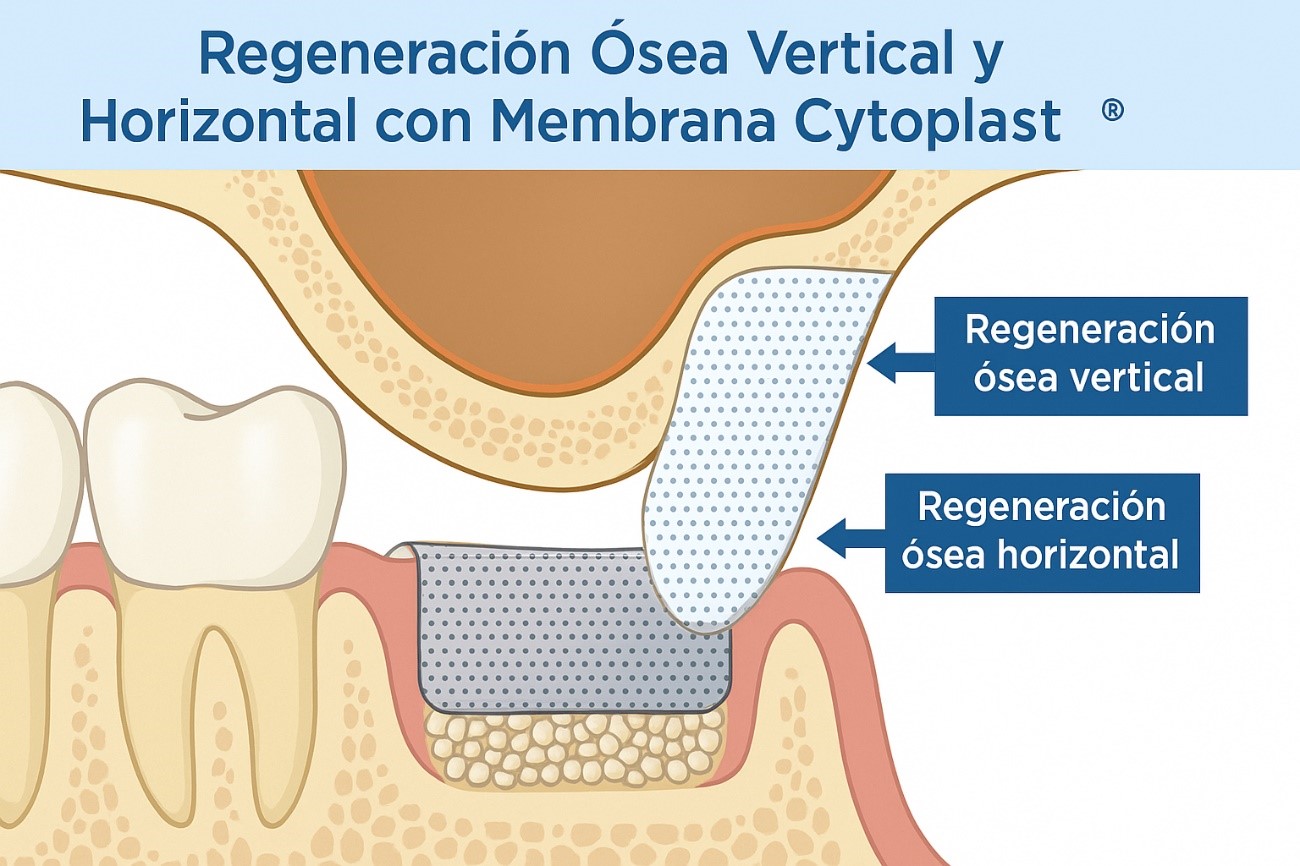 regeneracion