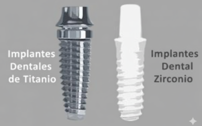 Titanio vs Zirconio: ¿Qué material es mejor para tus implantes dentales?