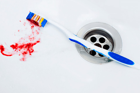Encías que sangran al cepillarse: causas, riesgos y tratamiento periodontal