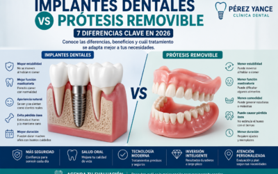Implantes dentales vs prótesis removible: 7 diferencias clave en 2026